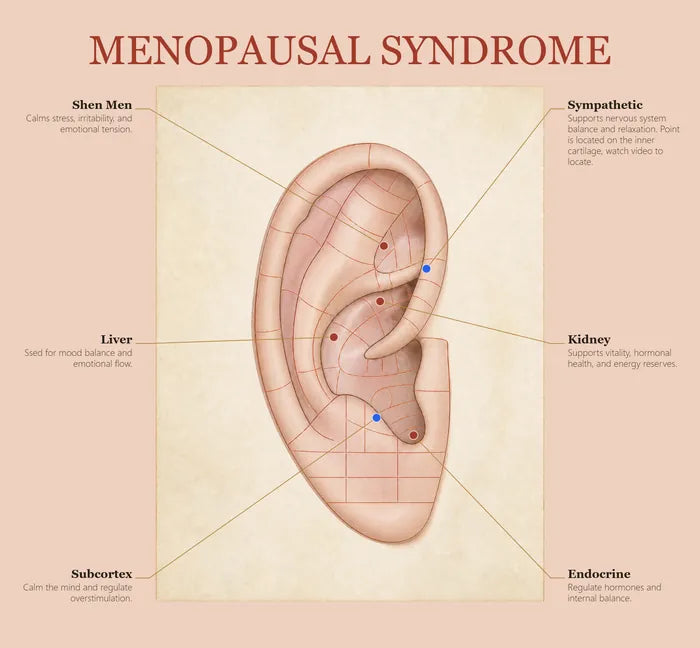 Menopausal Syndrome ear seed map