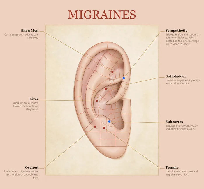 Migraines ear seed map