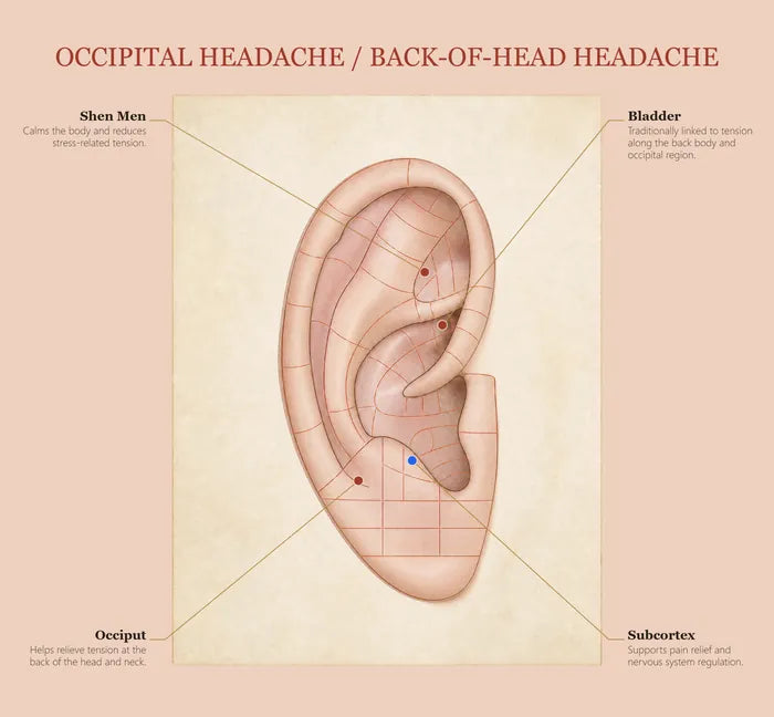 Occipital Headache ear seed map
