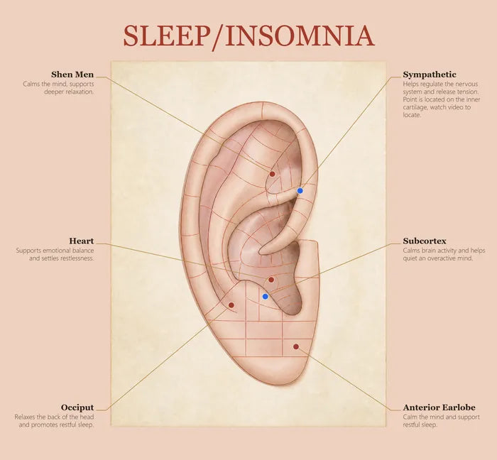 Sleep & Insomnia ear seed map